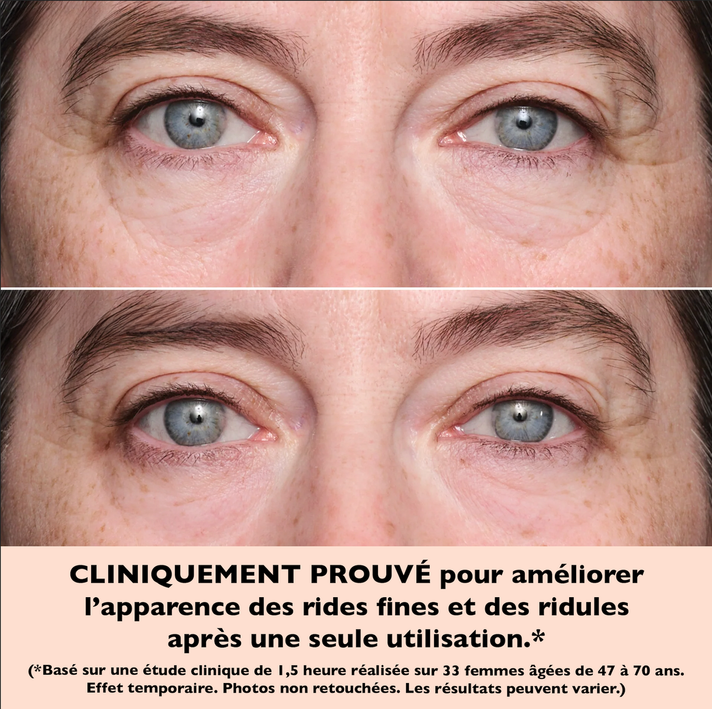 Patchs tonifiants pour les yeux (8 patchs)